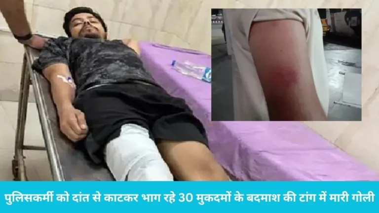 Kurukshetra Police Encounter: पुलिसकर्मी को दांत से काटकर भाग रहे 30 मुकदमों के बदमाश की टांग में मारी गोली