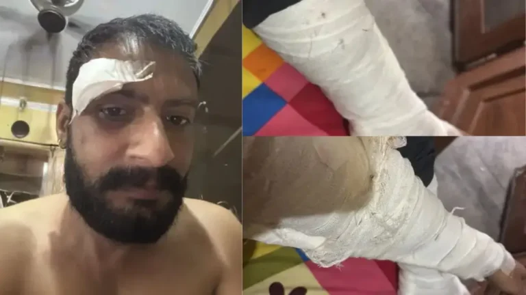 Yamunanagar crime news: जमानत पर बाहर आए हत्या के आरोपी को कार से घेरकर पीटा, लोहे की रॉड से हमला