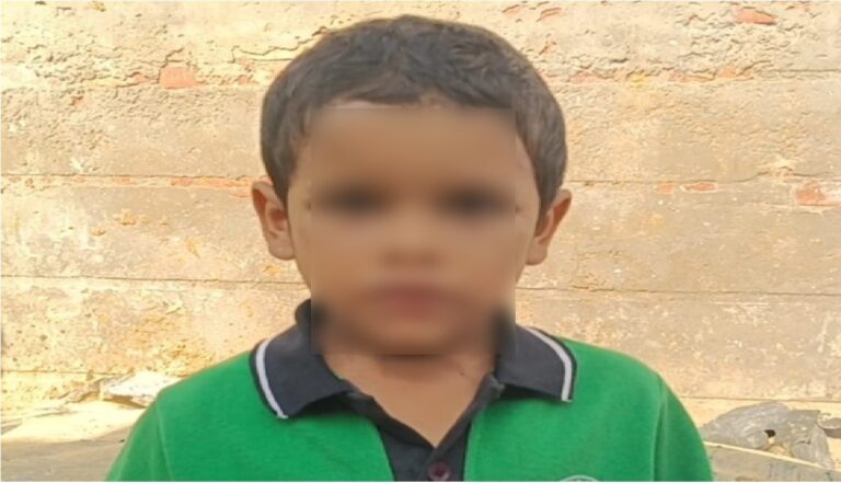 Barnala Crime : बरनाला में चाची ने 5 साल के मासूम को गर्म तवे और चिमटे से दागा