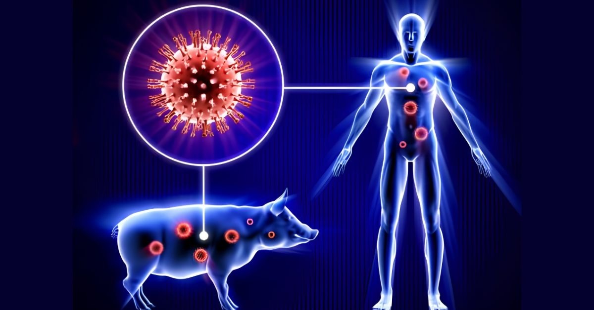Pathankot Swine Flu : पठानकोट में स्वाइन फ्लू का पहला केस मिलने से हड़कंप
