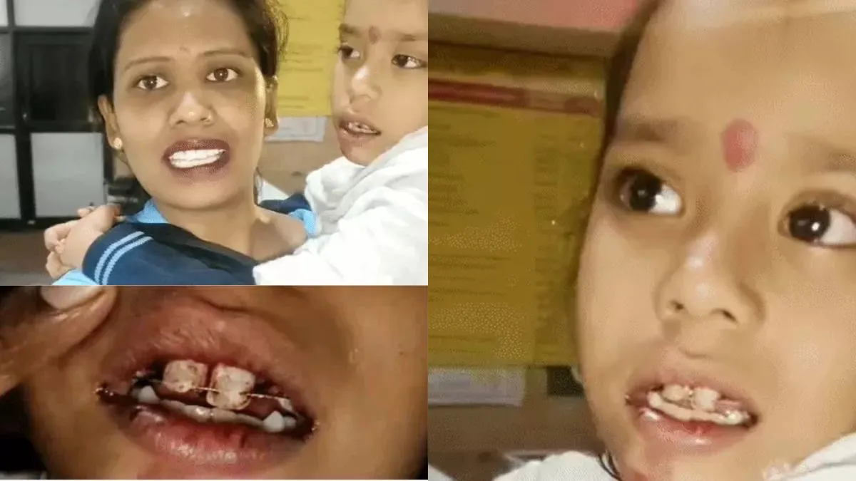 Ambala Cantt news: अंबाला कैंट में आवारा गायों के हमले में 9 साल की मासूम गंभीर, उखड़े दो दांत, मुंह की हुई वायरिंग