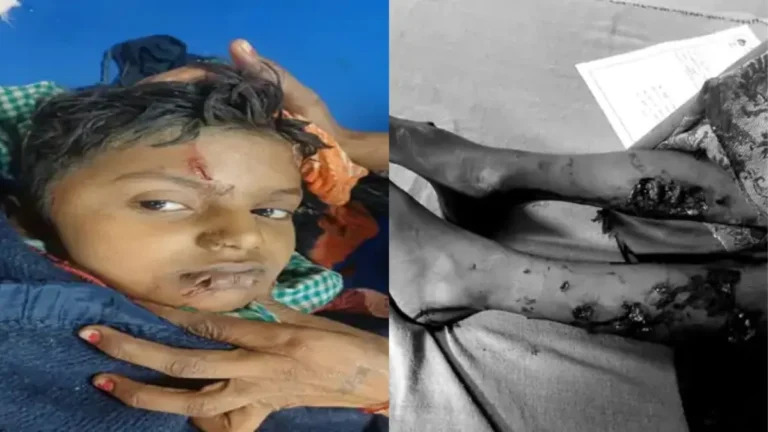 Ambala Stray Dogs Attack: अंबाला में आवारा कुत्तों ने 9 साल के मासूम को जमीन पर पटककर नोचा, शरीर पर 30 से ज्यादा घाव, PGI रेफर
